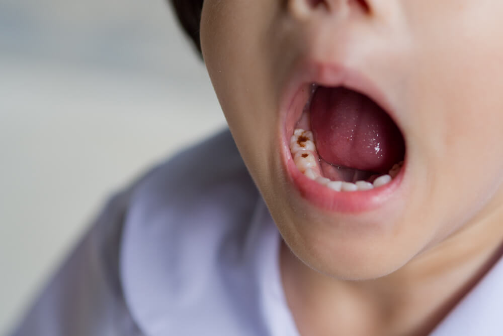 Baby Food Alert: Keep Your Baby's Teeth Healthy – Happy Coo